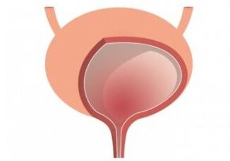 Bladder and strengthening of the orchestras femixal